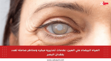 المياه البيضاء على العين: علامات تحذيرية مبكرة ومخاطر صامتة تهدد بفقدان البصر